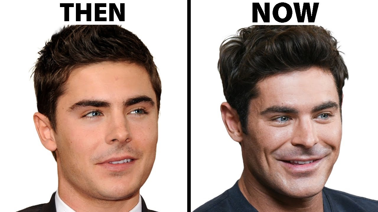 zac efron plastic surgery